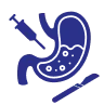 Gastroenterologic surgery