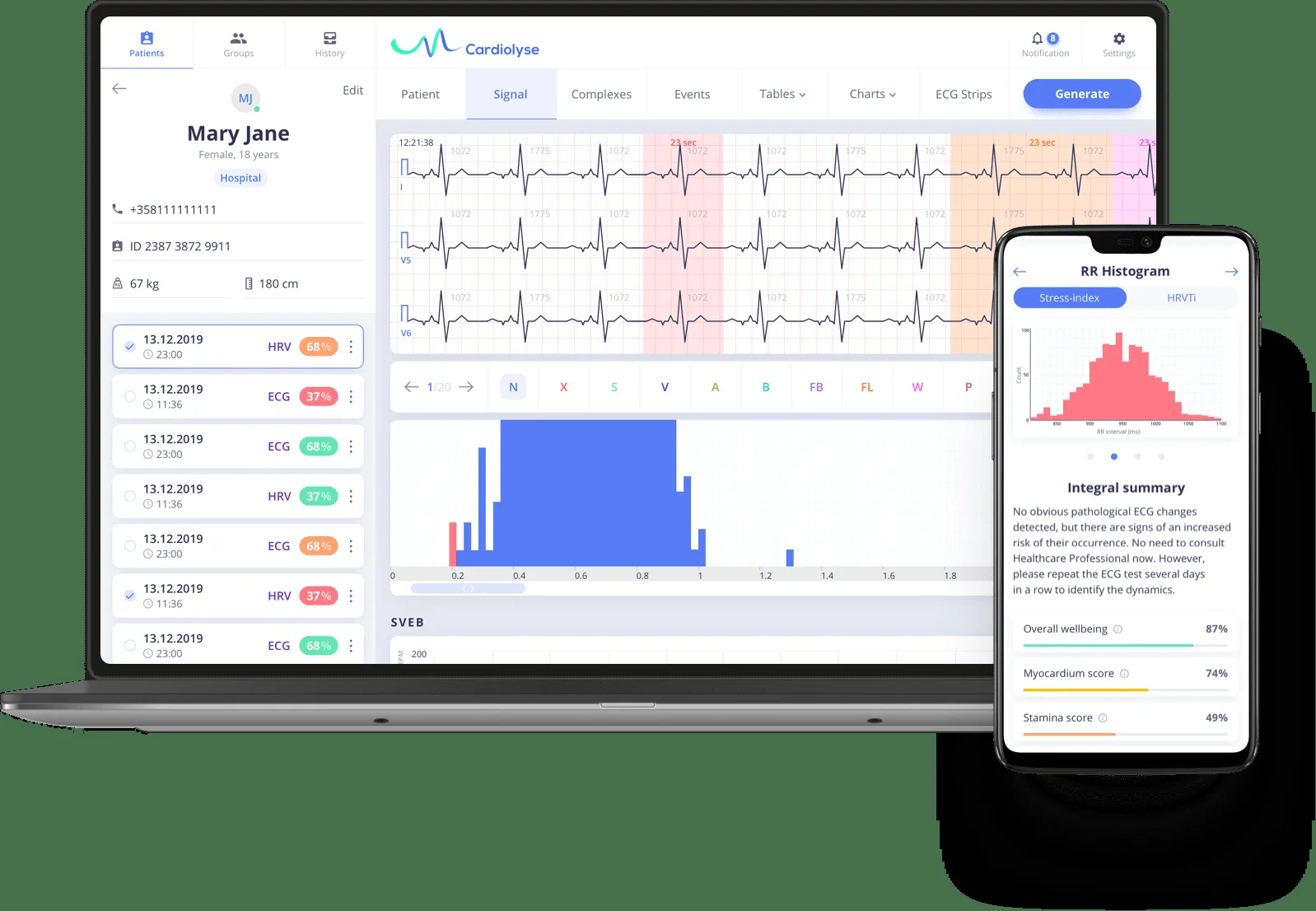 Remote cardiac monitoring